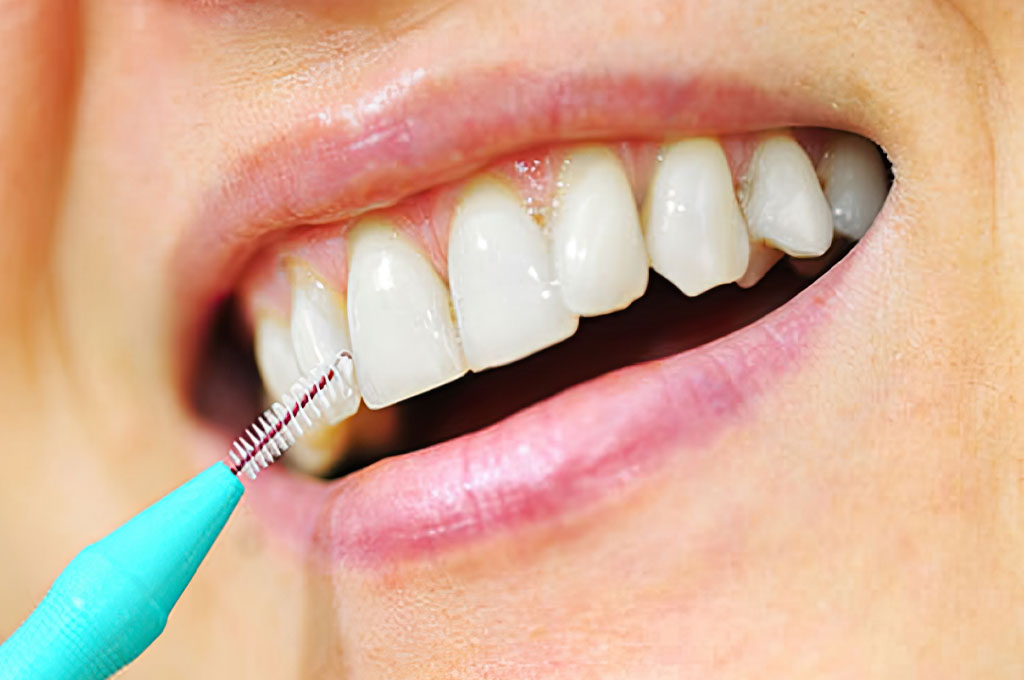 zahnprophylaxe mundhygiene zahnarztpraxisgemeinschaft dr. probst derendingen zahnarzt in solothurn