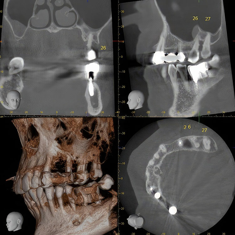 3D-Röntgen Zahnarzt-Gemeinschaftspraxis Dr. Probst Solothurn Derendingen